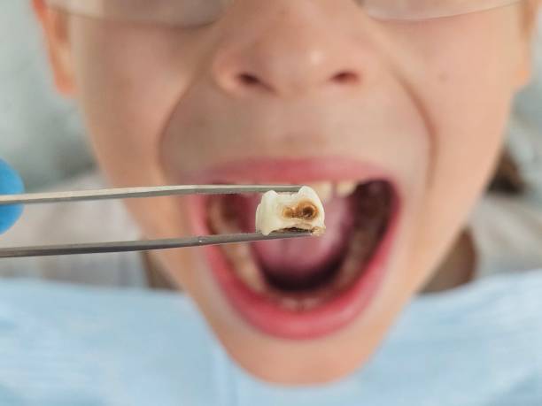 Best Pediatric Emergency Dentist in Springhill, LA